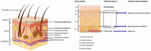 Figure 5. Schematic presentation of skin structure, types of cells and skin cancers