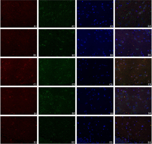 Figure 5 Effect of SMYZD on mitochondrial uncoupling protein 2 (UCP2) expression in the cerebral cortex of rats with chronic cerebral ischaemia (× 400).