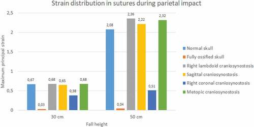 Figure 16. The maximum principal strain in sutures during parietal impact from 30 and 50 cm falls with different degrees of ossification in the sutures