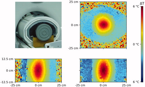 Figure 3. Perfax phantom on the wooden stands in the BSD2000–3D MR-compatible applicator in front of the MR scanner (left top) and axial (right top), transversal (left bottom) and coronal (right bottom) cross-sections through the measured temperature distribution in the Perfax phantom with (0,0) steering settings.