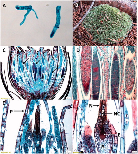 Figure 4. Moss gametophyte structures. (A) (C–F) Polytrichium species. (B) Leucobryum species. (A) Protonema. (B) Leafy gametophytes clustered together in a cushion. (C) Antheridia (arrows) surrounded by perigonial bracts at the terminus of the male leafy gametophyte. (D) Enlargement of antheridia exhibiting mitotically dividing cells, which will give rise to sperm. (E) Archegonia (A) surrounded by paraphyses (P) at the terminus of the female leafy gametophyte. (F) Enlargement of the archegonium (A), neck (N), neck canal (NC) and egg (E). All images except (B) were obtained from slides and used with permission from Carolina Biological Supply, Whitsett, North Carolina, Copyright Carolina Biological Supply.