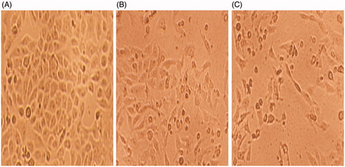 Figure 4. Phase contrast inverted microscope images of HeLa cells showing changes in the morphology of compound 1 treated cells. (A) Untreated control (B) 0.5 µg/mL (C) 0.75 µg/mL. Magnification: 100×.