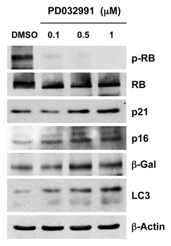 Figure 1. Treatment with PD0332991, a CDK4/6-inhibitor, induces markers of senescence and autophagy. hTERT-BJ1 fibroblasts were incubated with PD0332991 (0.1, 0.5 and 1 μM) for 36 h before the cells were harvested and subjected to immunoblot analysis with specific antibody probes. Note that PD0332991 effectively inhibits the phosphorylation of RB, as predicted. In addition, PD0332991 induces the upregulation of three markers of senescence [p21(WAF1/CIP1), p16(INK4A) and β-galactosidase]. Similarly, LC3 expression (an autophagy marker) is progressively upregulated. Blotting with β-actin is shown as a control for equal protein loading.