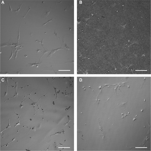 Figure 3 Differential interference contrast images of astrocytes cultured on (A) PLL glass, (B) nanofibrillar scaffolds, (C) Aclar, and (D) PLL Aclar.Note: Scale bars, 100 μm.Abbreviations: PLL Aclar, poly-L-lysine-functionalized planar Aclar; PLL glass, poly-L-lysine-functionalized planar glass.