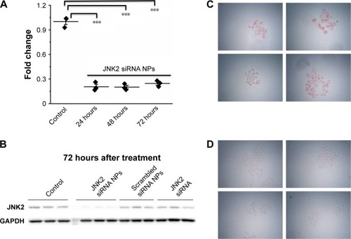 Figure 5 p5RHH-JNK2 siRNA NPs inhibit JNK2 expression at both mRNA and protein levels and restrict cellular acLDL uptake in RAW 264.7 cells.Notes: (A) RT2-PCR results demonstrate the JNK2 mRNA knockdown by p5RHH-JNK2 siRNA NPs (n=3 per group). (B) Western blotting shows JNK2 protein knockdown specifically by p5RHH-JNK2 siRNA NPs but not by p5RHH-scrambled siRNA NPs or free JNK2 siRNA (n=3 per group). (C and D) Knockdown of JNK2 results in prominent reduction of lipid accumulation (oil red O staining) in RAW 264.7 cells (D) when incubated with 50 μg/mL acLDL for 12 hours compared to untreated cells (C) (n=4 per group). ***P<0.001. C and D were captured at magnification of 4×.Abbreviations: acLDL, acetylated low-density lipoprotein; NPs, nanoparticles; PCR, polymerase chain reaction; RT, reverse transcription.