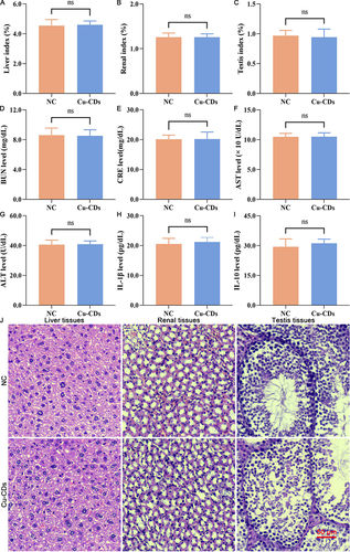 Figure 3 In vivo biocompatibility assessment of Cu-CDs. (A) Liver index. (B) Renal index. (C) Testis index. (D) BUN level. (E) CRE level. (F) AST level. (G) ALT level. (H) IL-1β level. (I) IL-10 level. (J) HE staining. ns represents P>0.05.