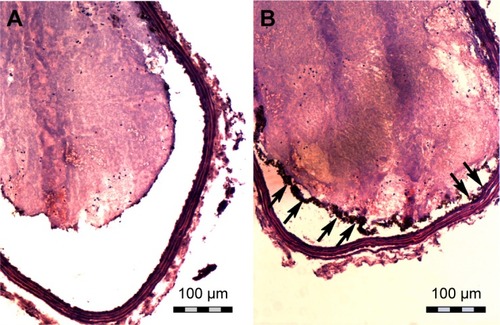 Figure 7 Hematoxylin and eosin staining of frozen sections of the ex vivo thrombus after injection of the NPs.Notes: (A) Fe3O4-PLGA NPs and (B) Fe3O4-PLGA-cRGD NPs. Many of the Fe3O4-PLGA-cRGD NPs gathered on the surface of the thrombus (black arrows), and no NPs were found on the surface of the thrombus in the sample with Fe3O4-PLGA NPs. The magnification is 200×.Abbreviations: cRGD, cyclic Arg-Gly-Asp; NPs, nanoparticles; PLGA, poly(lactic-co-glycolic acid).