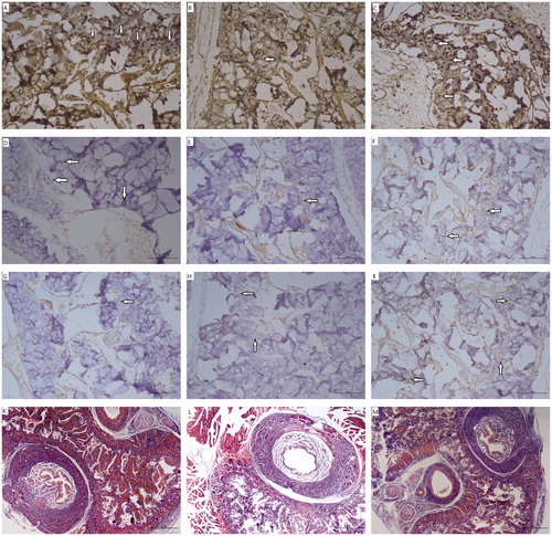 Figure 1. (A–M). Immunohistochemical studies (×200) and Masson’s trichrome (MT) staining (×40) results in the cavernosal tissue. nNOS staining with decreased localization to the nerves of the corpus cavernosum from group C (A) to group D (B) and with improved localization as similar to group C (A) in group D + T (C). Reduced eNOS staining in cavernous sinus endothelial cells was observed in group D (E) compared to group C (D). Group D + T (F) had similar eNOS immunoreactivity with group C (D). iNOS staining enhanced in the corpus cavernosal smooth muscle of group D (H) and group D + T (I) as the greatest compared to group C (G). Markedly decreased smooth muscle content and increased collagen were observed in Masson’s trichrome staining of group D (L). No difference in the ratio of SM/C was observed between group C (K) and group D + T (M).