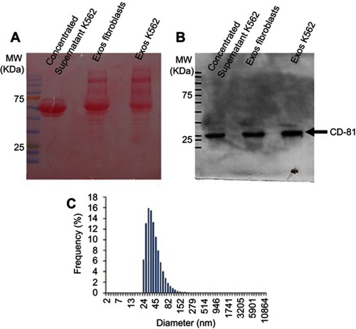 Figure S1 Evaluation of exosome isolation. Supernatant of Fibroblasts and K562 cells was collected, filtered in a 0.2μm filter and concentrated in Centrifugal Filter Devices with 3KW cut-off. An aliquot of the K562 concentrated supernatant was collected and analysed (Concentrated supernatant K562). Total exosome isolation reagent for culture media (ThermoFisher) was added to each concentrated supernatant and exosomes collected according to the manufacturer’s instructions (Exos Fibroblasts and Exos K562). For Western-Blot analysis, 40μg of protein from each sample was separated by SDSPAGE, transferred to a PVDF membrane and stained with Ponceau solution (A). The presence of CD-81 tetraspanin was then analysed with CD-81 antibody (1D6, Novus biologicals Cat# NB100-65805, RRID:AB_962702) (B). The expected weight of CD-81 is 26KDa. Dynamic light scattering of particle distribution in K562 exosome suspension (C)