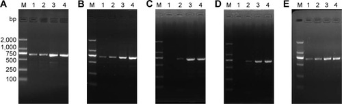 Figure 6 Effect of Mg2+ concentration on PCR assisted by GO and its derivatives.Notes: M: DNA marker. (A) GO (9.6 μg mL−1). (B) GO-PAA (4.8 μg mL−1). (C) GO-PAM (8.0 μg mL−1). (D) GO-PEG (24.0 μg mL−1). (E) GO-pSB (24.0 μg mL−1). The concentration of added Mg2+ in lanes 1–4 is 0 mM, 0.4 mM, 1.0 mM and 2.0 mM, respectively (the original 2 mM Mg2+ was not included).Abbreviations: GO, graphene oxide; PAA, polyacrylic acid; PAM, polyacrylamide; PCR, polymerase chain reaction; PEG, polyethylene glycol; pSB, poly(sulfobetaine).
