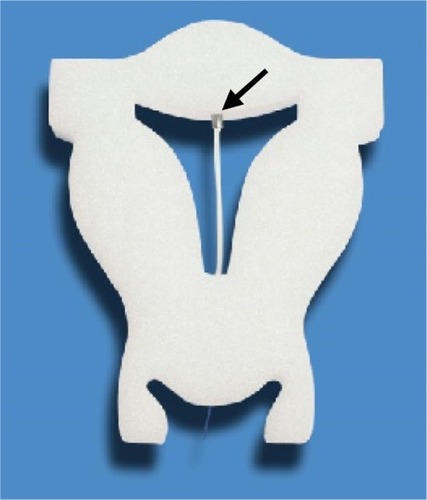 Figure 2 The FibroPlant® LNG-IUS is shown inserted in a foam uterus with stainless steel clip at the upper end (arrow).