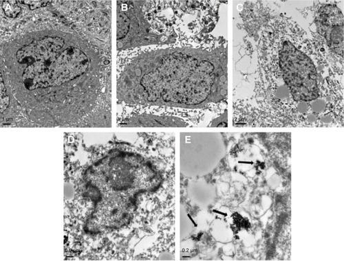Figure 6 Ultrastructure of SMMC-7721 cells (observed by TEM).Notes: Sections from the blank control group (A); gene transfection-alone group (B); thermotherapy-alone group (C); and combined therapy group (D and E) are shown. TEM examination revealed that the necrotic areas in C and D were much larger than the intrinsic necrosis of the tumor shown in A and B. The black arrows indicate the magnetic nanoparticles. Magnification: A–C ×6,000; D ×12,000; E ×30,000.Abbreviation: TEM, transmission electron microscopy.