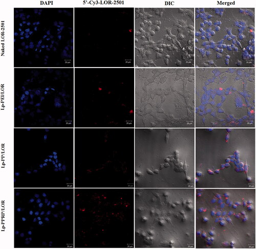 Figure 7. Intracellular localization of 5′-Cy3-labled LOR-2501 delivered by Lp-PEI, Lp-PP, and Lp-PPRP in HeLa cells shown by confocal microscopy. 5′-Cy3-labled LOR-2501 is shown in red, DAPI nuclear stain is shown in blue. Scale bar = 20 μm.