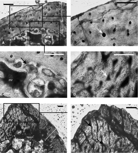 FIGURE 4 Temnospondyli indet, ribs. A–C, ISIA181/5, showing A, a thick compact cortex surrounding a medullary region; B, inset I of A at higher magnification showing woven fibered bone matrix and longitudinally oriented primary vascular channels (arrow); C, inset II of A showing large resorption cavities (arrow) in the perimedullary region; D–F, ISIA181/6, showing D, woven fibered bone matrix with primary vascular channels (arrow) in the cortex; E–F, profuse radially arranged vascular channels; F, inset of E at higher magnification. Arrows indicate two sets of radially arranged vascular channels; one running from the inner to mid cortex and the other from mid to outer cortex. All figures are of transverse sections. Scale bars equal 300 μm.