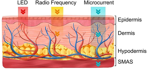 Figure 1 Home beauty devices for facial rejuvenation utilize technologies including radiofrequency (RF), LED, and microcurrent. These technologies provide thermal, light, and electric stimulation to different layers of the skin.