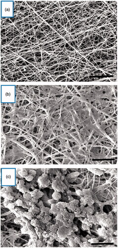 Figure 2. Morphological changes of cultured cells on the PES nanofibrous scaffold. (a) Unseeded scaffold with interconnected pores. (b) hiPSCs-seeded on the nanofibrous scaffold (control group). The cells show spindle-shaped morphology. (c) The hiPSCs-seeded scaffold in IPC differentiation media at day 21. The cells are round in shape and form spherical dense clusters. Scale bars are a, b: 30 µm and c: 10 µm.