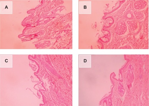 Figure 12 A–D The microstructure of a rabbit back skin section, viewed under a light microscope.Notes: (A) Microemulsion (ME) without total flavone of rhizoma arisaematis (TFRA) on intact skin; (B) TFRA-loaded ME on intact skin; (C) ME without TFRA on injured skin; (D) TFRA-loaded ME on injured skin; (×100).