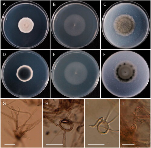 Figure 10. Morphology of Roussoella doimaesalongensis. (A, D) Colonies on PDA; (B, E) Colonies on MEA; (C, F) Colonies on OA ((A–C) obverse view; (D–F) reverse view). (G–I) Hyphae and coiled hyphae; (J) Chlamydospores (scale bars: G–I = 20 μm; J = 10 μm).