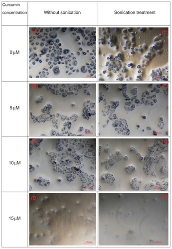 Figure 7 Optical microscope images of oral squamous cell carcinoma-25 cell lines stained by trypan blue; (A–D) show the microscopic images of cells with curcumin concentrations at 0 μM, 5 μM, 10 μM, and 150 μM without sonication, and (E and H) show the microscopic images of cells with curcumin concentrations at 0 μM, 5 μM, 10 μM, and 15 μM after sonication treatment.Note: Those images show the synergy of microemulsion treatment with ultrasound in producing cytotoxicity.