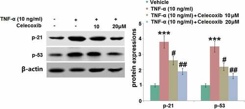 Figure 7. The effect of Celecoxib on the increased expression of p21 and p53induced by TNF-α in human C-28/I2 chondrocytes. Cells were treated with TNF-α (10 ng/ml) in the absence or presence of Celecoxib at concentrations of 10, 20 μM for 6 hours. The expressions of p21 and p53 were detected using western blots (***, P < 0.005 vs. vehicle group; #, ##, P < 0.05, 0.01 vs. TNF-α group)