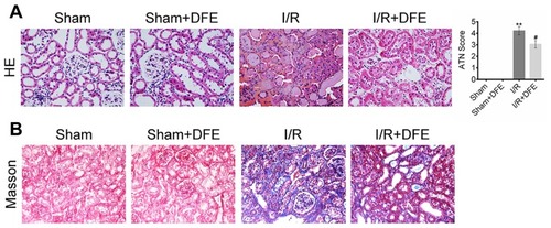 Figure 2 DFE preconditioning alleviated I/R-induced renal histological injury. (A) The renal histological injury of four groups was measured by HE staining and ATN valuing. (B) The renal fibrosis of four groups was determined by Masson trichrome staining. Data were shown as mean ± SD. **P < 0.01 vs sham group, #P < 0.05 vs I/R group.