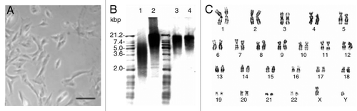 Figure 2. (A) Human AFS cells mainly display a spindle-shaped morphology during in vitro cultivation under feeder layer-free, serum-rich conditions. (B and C) Clonal human AFS cell lines retain long telomeres and a normal karyotype after more than 250 cell divisions. (B) Conserved telomere length of AFS cells between early passage (20 population doublings, lane 3) and late passage (250 population doublings, lane 4). Short length (lane 1) and high length (lane 2) telomere standards provided in the assay kit. (C) Giemsa band karyogram showing chromosomes of late passage (250 population doublings) cells. Adapted from reference Citation35.