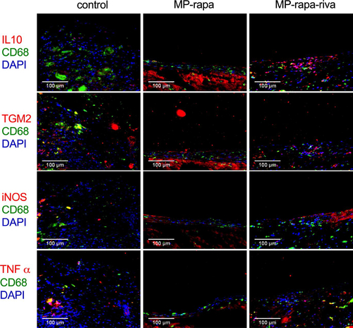 Figure 6. M1 and M2 macrophages in the neointima after rat IVC patch venoplasty at day 14. Photographs of the immunofluorescence of the neointima, first row, CD68(green), IL10 (red) and DAPI (blue); second row, CD68(green), TGM2(red) and DAPI (blue); third row, CD68 (green), iNOS (red) and DAPI (blue); forth row, CD68(green), TNFα (red) and DAPI (blue); scale bar, 100 μm; n = 3.