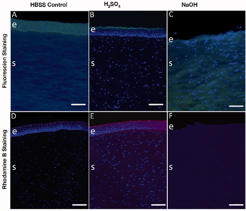Figure 3. Fluorescent images demonstrating the altered adsorption of hydrophilic and hydrophobic agents after chemical injury. Porcine cornea injured with 1 M H2SO4 (B, E) and 1 M NaOH (C, F) were compared to HBSS controls (A, B) 60 min after the addition of fluorescein (A–C; hydrophilic, green signal) and rhodamine B (D–F; hydrophobic, red signal). Sections were counterstained with the nuclear dye DAPI. Scale bar = 100 µm; e: epithelium; s: stroma.