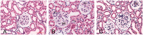 Figure 2. Light photomicrographs showing the kidney morphology by hematoxylin and eosin stain (400×). (A) A control rat, (B) a diabetic rat and (C) a Puerarin-treated rat. The diabetic glomerular lesion is characterized by mesangial expansion (ME), global sclerosis (GS). There is tubular atrophy (TA), interstitial fibrosis (IF) and focal interstitial inflammation (IFL).