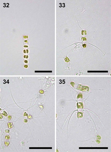 Figs 32–35. Chain and setae types; light microscopy. Fig. 32. Typical length chain with the bowed, somewhat thicker end setae. Fig. 33. Shorter chain of cells showing a pair of heavy intercalary setae. Fig. 34. Short chain showing the end and typical, thin intercalary setae. Fig. 35. Short chain showing variation in orientation of heavy intercalary setae. Scale bars: Figs 32–35, 25 µm.