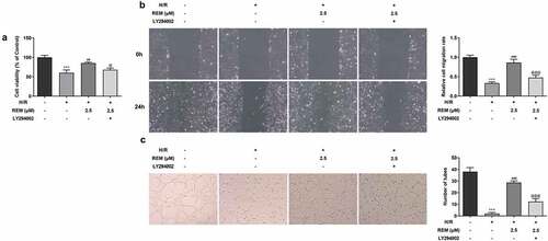 Figure 5. PI3K/Akt inhibition rescues REM-promoted HCMEC viability, migration and angiogenesis after H/R The viability (a), migration (b) and tube-like structure formation (c) of HCMECs treated with REM following H/R in the presence of LY294002, correspondingly detected by CCK-8, wound healing and Matrigel angiogenesis assay. ***P < 0.001 vs Control; ##P < 0.01, ### P < 0.001 vs Model; @P < 0.05, @@@P < 0.001 vs H/R+ REM