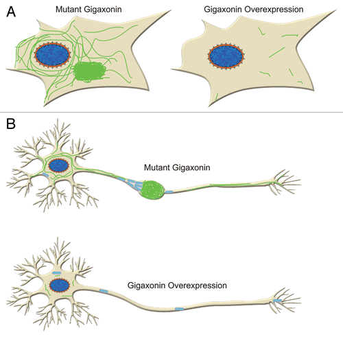 Figure 2. Gigaxonin overexpression clears IF in fibroblasts (A) and neurons (B). In neurons this is likely to lead to improvement of axonal transport of organelles such as mitochondria as they are no longer hindered by IF aggregation.