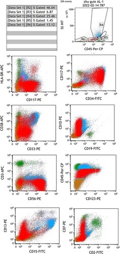 Figure 2. Flow cytometry results for the patient, R2 46.04% blasts, which expressed CD10/34/38/117/123, weakly expressed CD7/33/45, and strongly expressed CD56, do not express HLA-DR, CD2/3/4/5/11b/11c/13/14/15/16/19/20/36/64/303 and cCD3/79a.