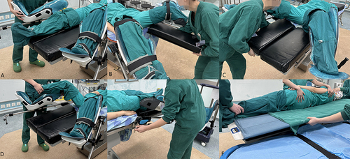 Figure 1 Traditional over-bed method. Placement—(A): Install stirrup legs and positioning; (B): Remove the foot plate. Repositioning—(C): Install the foot plate; (D): Flat one’s legs and repositioning; (E): Remove stirrup leg. Transition to the bed—(F): Transition to the bed.