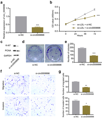 Figure 2. Down-regulation of hsa_circ_0008896 inhibited proliferation, migration and invasion in vitro. (a) The expression level of hsa_circ_0008896 after si-circ_0008896 transfection was detected using quantitative PCR. (b) CCK8 assay was conducted to measure cell viability after down-regulation of hsa_circ_0008896. (c) The expression levels of two proliferation markers, Ki67 and PCNA after down-regulation of hsa_circ_0008896 were detected using Western blotting. (d) Colony formation assay was conducted to examine proliferation ability after down-regulation of hsa_circ_0008896. (e) The quantification results of (d). (f) Transwell migration and invasion assays were conducted to examine the migration and invasion abilities of VSMCs after down-regulation of hsa_circ_0008896. (g) The quantification results of (f). *P < 0.05, **P < 0.01, ***P < 0.001.