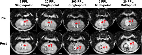 Figure 6. Representative pre- and post-treatment T2-weight MRI for GL261 tumors. Each column represents one mouse. The tumor (T) is represented by a hyperintense region in the pre- and post-treatment images, and the ablation zone (black outline) is represented by a hypointense region with a hyperintense core in the post-treatment images. The ablation volume increased with increasing dosage. All scale bars = 2 mm.