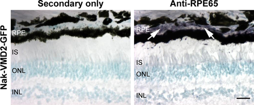 Figure S2 RPE65 expression in the baboon eye.Notes: Sections from an eye injected with naked-VMD2-GFP were incubated with RPE65 antibody (right, purple) or secondary antibody alone (left). Nuclei are counterstained with methyl green (teal). Arrows indicate purple RPE65 labeling in the RPE. Images are from animal 7R. Images captured at 40×, scale bar 25 µm.Abbreviations: INL, inner nuclear layer; IS, inner segment; ONL, outer nuclear layer; RPE, retinal pigment epithelium.