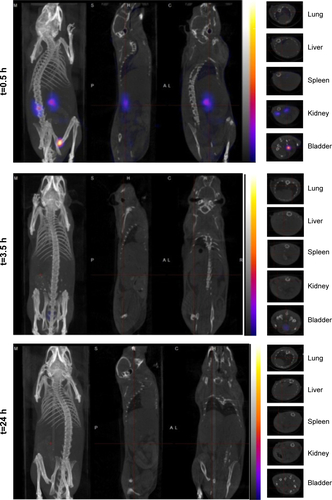 Figure S5 SPECT/CT images of [111In]DTPA control injected mouse at 0.5, 3.5, and 24 hours (h) postinjection.Notes: The bright areas indicate the accumulation of [111In]DTPA. Images from left to right show whole-body, sagittal, frontal, and transverse views. Cross-sectional images of the spleen, liver, lung, kidney, and urinary bladder are shown in the right column.Abbreviations: SPECT/CT, single photon emission computed tomography/computed tomography; DTPA, diethylenetriaminepentaacetic acid.