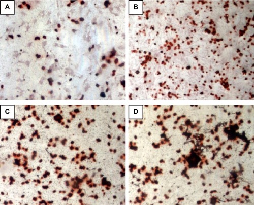 Figure 8 Mineralization (Alizarin red staining) assay. (A: PLGA, P0, B: P2, C: P4, and D: P8).Notes: P2, P4, or P8 represents the PLGA scaffold coated by MBG precursor solution for 2, 4, or 8 times, respectively. P0 represents the unmodified PLGA scaffold.Abbreivations: MBG, mesoporous bioactive glass; PLGA, poly(lactic-co-glycolic acid).