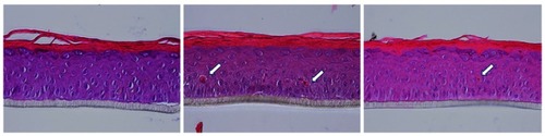 Figure 3 SBCs in (left to right) non-irradiated untreated control, irradiated untreated control and irradiated product-treated skin (SBCs indicated with arrows, showing as dark, condensed and/or fragmented nuclei and bright pink eosinophilic cytoplasm) (objective lens ×40). Digital images were captured with a NIKON DS-Ri1 and processed with NIS-Elements 4.13.04 software.