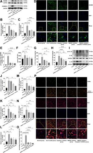 Figure 2 The livers of ACLF rats showed severe hepatocyte pyroptosis.