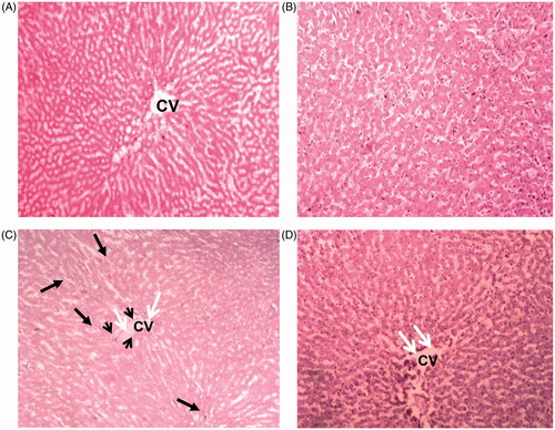 Figure 6. Photomicrographs of H & E (hematoxylin and eosin) stained sections of the liver of control rats and the rats treated with turmeric alone showing (A & B) normal histological structure of the central vein (CV) and surrounding hexagonal hepatocytes. (C) CF-treated rat livers showed severe disruption of the cellular arrangement radiating from the central vein (CV) and in the lobule (long black arrows), degeneration of hepatocytes at the peripheral area of the CV (short black arrows) and congestion in the CV associated with inflammatory infiltrates (white arrows). (D) A liver section of the animals treated with turmeric +CF, showing a remarkable degree of preservation in the cellular arrangement with only mild inflammation observed. [Magnification: 40X].