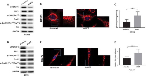 Figure 4. MET regulates DRP1 activation and mitochondrial morphology. a&d. Knockdown of MET downregulated activated DRP1 in H1993 and H2373 cells. b&e. Knockdown of MET induces elongated mitochondria in H1993 and H2373 cells. Inlets represent an enlarged part of the cells to show details of mitochondrial morphology. c&f. Quantification of mitochondrial lengths. The numbers showed the averages of at least 20 measurements per cell from 50 cells. Data analysis were carried out by Prism software. Error bars indicate standard error of the mean. *p < 0.05, **p < 0.01, ***p < 0.001.