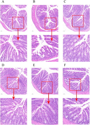 Figure 7. Rhei radix et rhizoma-carbon dots ameliorate the histological changes of DSS-induced UC in mice. Histopathological sections of each group (A-F) were stained with H&E, scale bar = 50μm, 200×; 100μm, 400×. (A) Control group [normal saline]. (B) Model group [DSS]. (C) Positive group [Sulfasalazine]. (D) RRR-CDs High-does group. (E) RRR-CDs Mediun-dose group. (F) RRR-CDs Low-dose group.