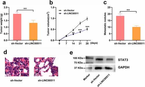 Figure 7. LINC00511 knockdown suppresses the tumor growth and lung metastasis of GC cells in vivo. A. MGC-803 cells with LINC00511 knockdown or the control cells were inoculated into the mice subcutaneously, respectively, and after the mice were sacrificed, the the tumor weight of the mice was measured (n = 5 in each group). B. Tumor volume of the mice in both groups was measured every 7 days (n = 5 in each group). C. MGC-803 cells with LINC00511 knockdown or the control cells were injected into the mice via tail vain, respectively, and after the mice were sacrificed, the number of metastatic nodules in the lung tissues of the mice was examined (n = 5 in each group). D. H&E staining was used to evaluate the metastasis of MCG-803 cells in the lung tissues sections (scale bar = 25 μm). E. Western blot assay was used to detect the expression of STAT3 in the tumor tissues of both groups