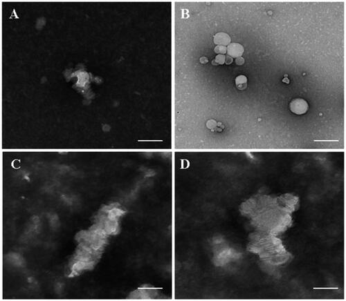 Figure 8. Microphotographs of different preparations using transmission electron microscope. (A) d-rHDL without LCAT; (B) d-rHDL incubation with LCAT; (C) m-d-rHDL without LCAT; (D) m-d-rHDL incubation with LCAT. The bar of A was 50 nm. The bar of B was 100 nm. The bar of C and D was 20 nm.