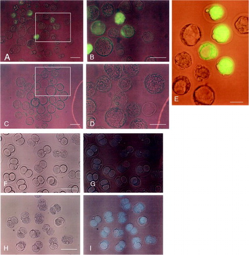 Figure 3.  Fluorescence at the blastocyst stage after 1 day culture of 8-cell embryos. A) Embryos derived from those shown in Figure 2. A, B. B) Magnified view of the box region shown in (A). C) Embryos derived from those shown in Figure 2. C, D. D) Magnified view of the box region shown in (C). E) Embryos derived from mating between a heterozygous MNCE-36 transgenic female and a non-transgenic male. Note the uniform, bright fluorescence among transgenic embryos. F–I) Two cell embryos recovered 6 h after instillation of Hoechst 33342 (H, I), or of water alone (F, G). F, H) observed under light; A–E, G, I) observed under light + UV illumination. Scale bars = 100 µm.