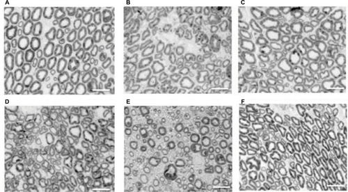Figure 4 Micrograph images of the sciatic nerve of a nondiabetic rat (A–C) and a diabetic rat (D–F). (A, D) Compression for 4 weeks and the release groups. (B, E) The compression-only groups. (C, F) The sham surgery groups. The nondiabetic rat experiments indicated that the 4-week nerve compression-only group revealed numerous small diameter myelin that were not present in the 4-week compression and release group. The diabetic rat experiments indicated that the 4-week compression-only group showed massive deconstruction and decreased myelin thickness compared with the sham surgery group. The small diameter myelin slightly increased in the diabetic 4-week compression and release group. Scale bar: 20 µm.
