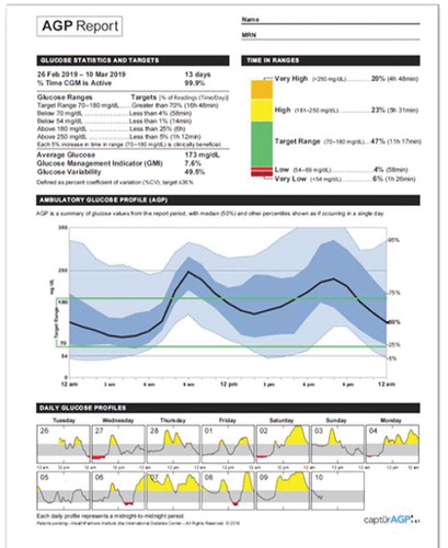 Figure 2. Example Ambulatory Glucose Profile Report [Citation38]