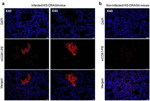 Figure 6. Intra-Alveolar microthrombi in SARS-CoV-2 infected DRAGA mice.